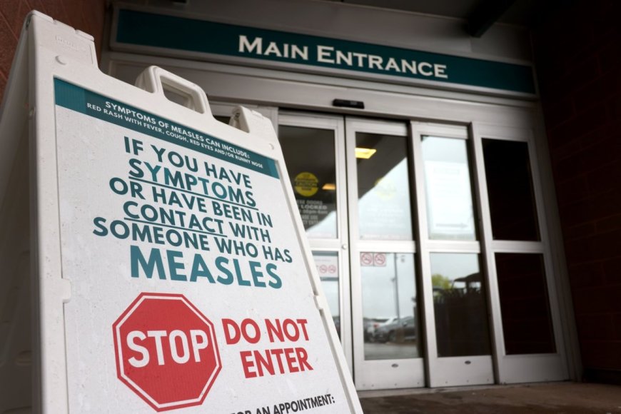 Measles Cases Confirmed in Chilliwack Residents by B.C. Health Authorities
