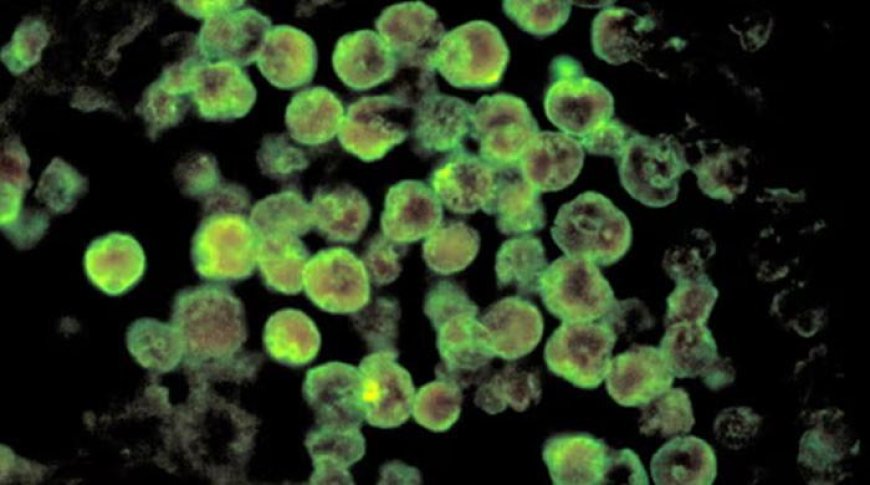 Karachi records fourth Naegleria fatality in 2025