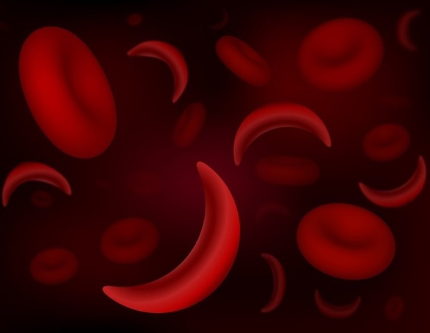 Gene Therapy Shows Promise in Reducing Stroke Risk for Sickle Cell Patients