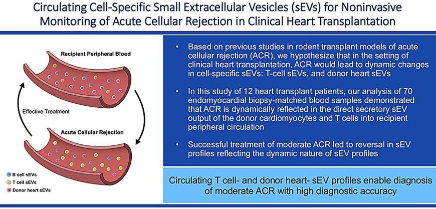 Simple Blood Test Shows Promise in Detecting Heart Transplant Rejection Early
