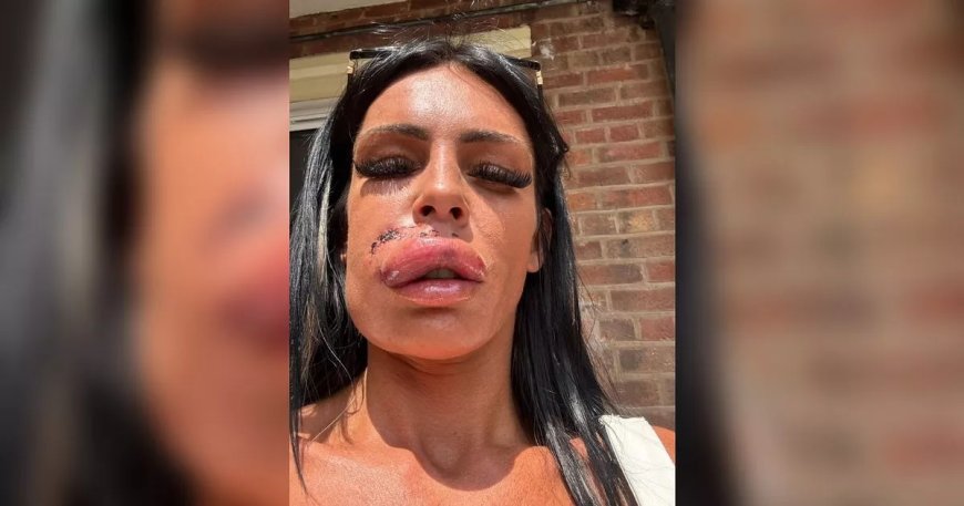 Woman's Face Injured in Dog Attack on Mathew Street