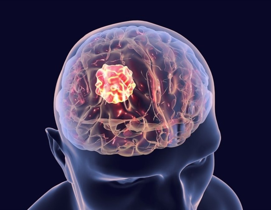 FAU Researchers Receive Grants to Target New Gene for Glioblastoma Treatment