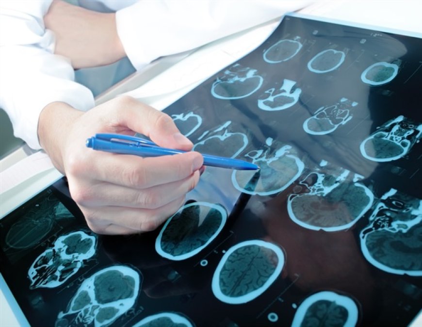 Promising Results from Epilepsy Self-Management Program