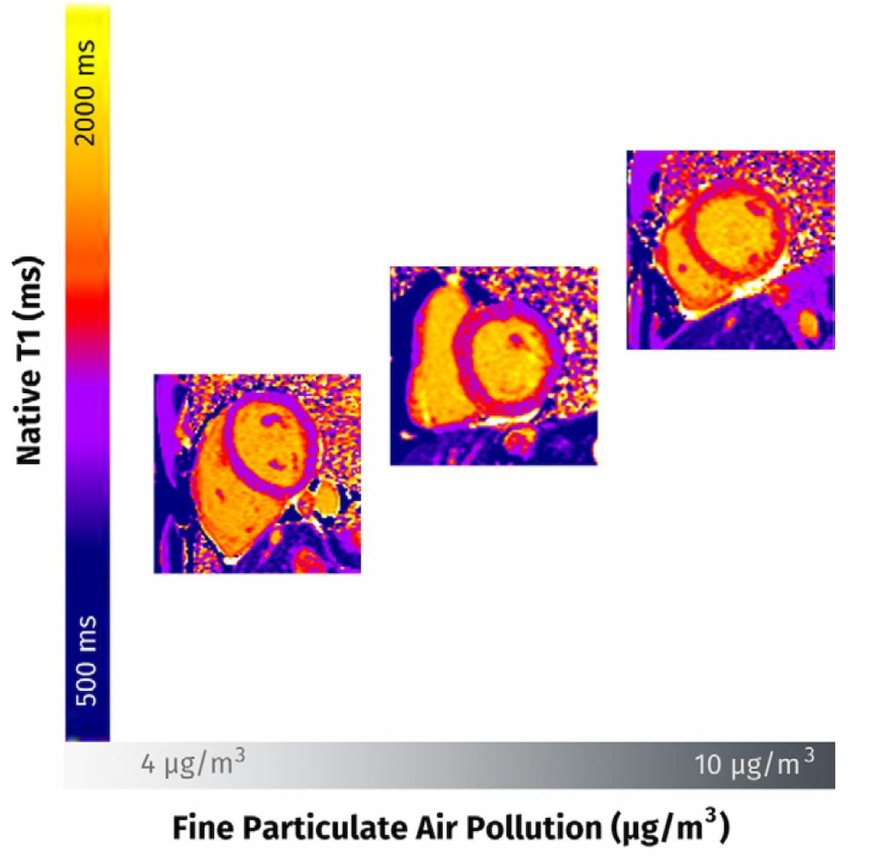 Study Shows Air Pollution Exposure Linked to Heart Damage