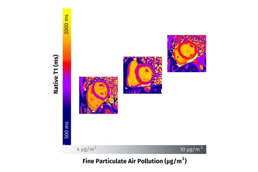 Study Shows Air Pollution Harms Heart Health