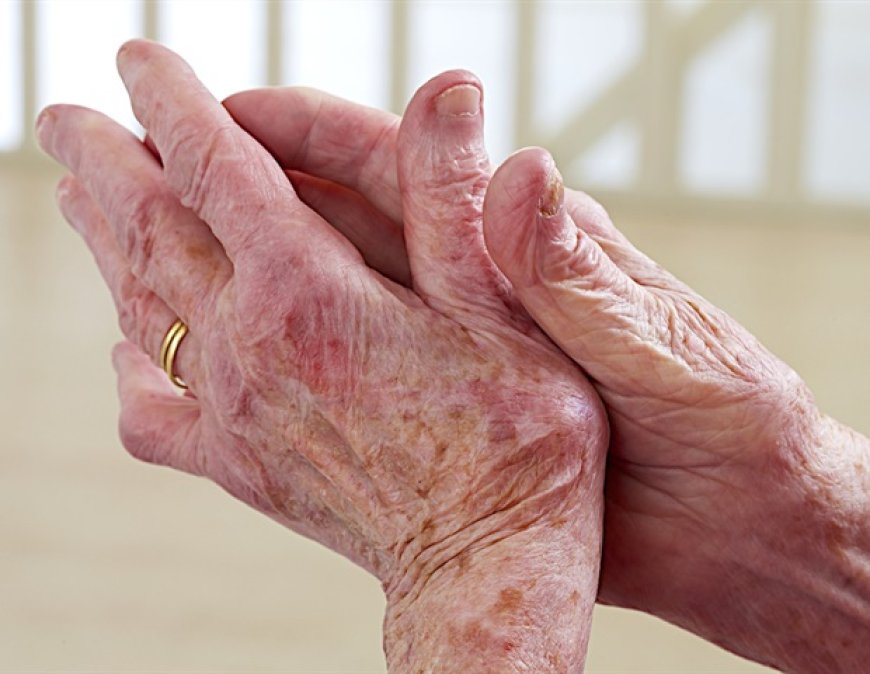 Insight into Juvenile Idiopathic Arthritis from Immune Cell Analysis