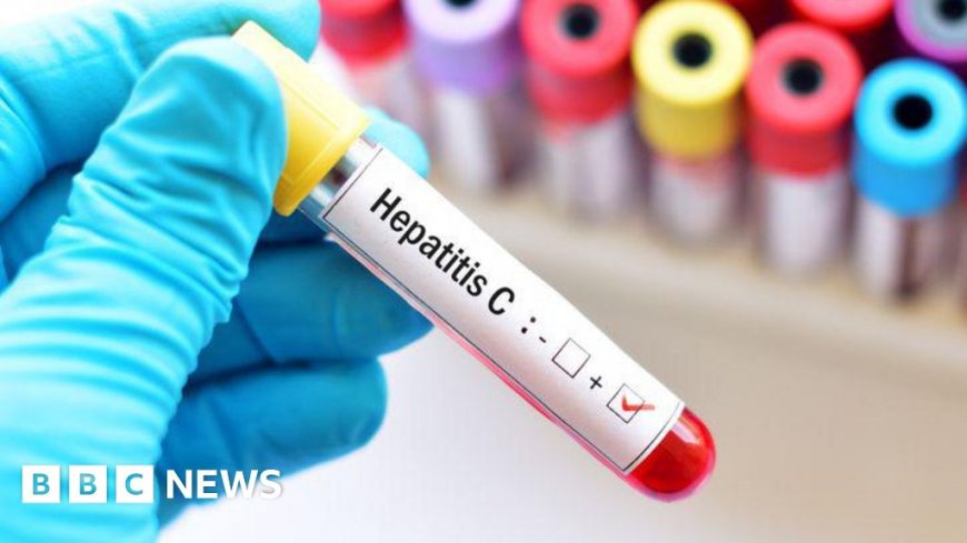 Mobile Units Offer Hepatitis C Testing in Hull and Surrounding Areas