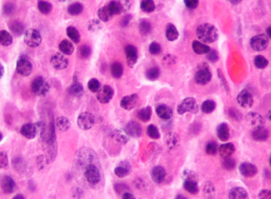 Ireland's First BioBrillouin Microscope for Non-Invasive Cell and Tissue Assessment