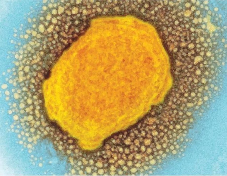 Study Shows Blood Viral Load Can Predict Severity of Mpox Symptoms