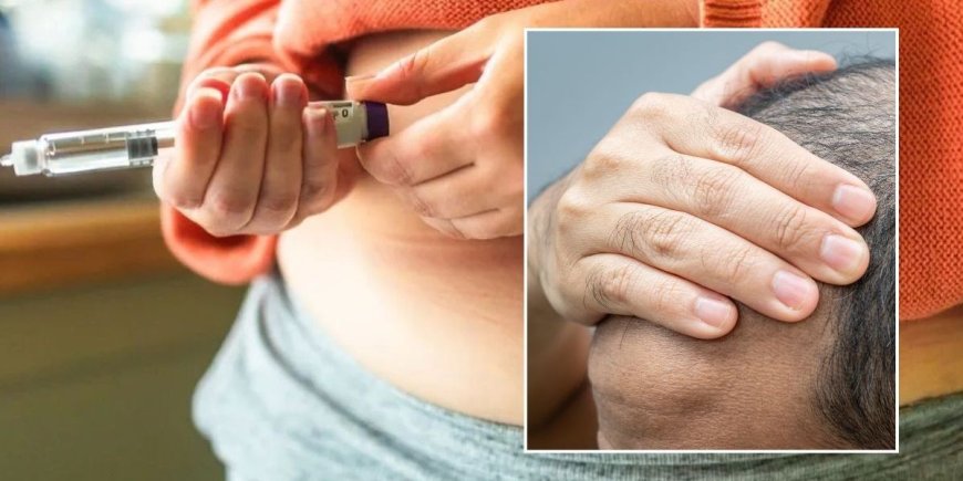 Understanding 'Mounjaro Hair': Common Side Effect of Diabetes Medication