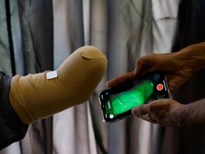Pakistani Startup Sends Custom Prosthetic Limbs to Gaza's Youngest Victims
