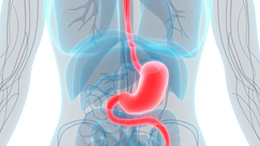 Study: Over 15 Million People Born Between 2008-2017 Could Develop Gastric Cancer