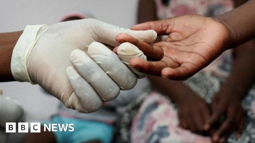 HIV Patients Concerned About Treatment Amid US Aid Cuts