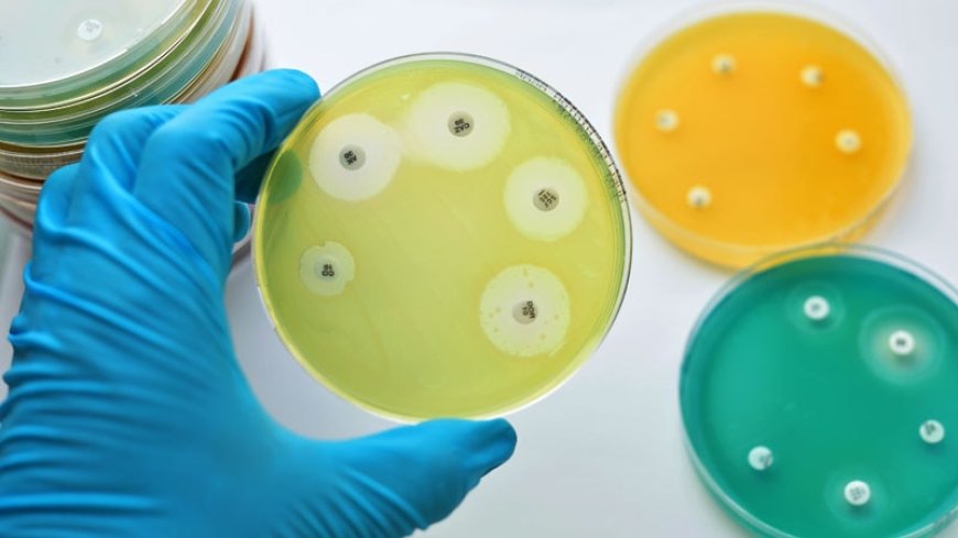 Understanding Antimicrobial Resistance (AMR) and Its Impact on Public Health