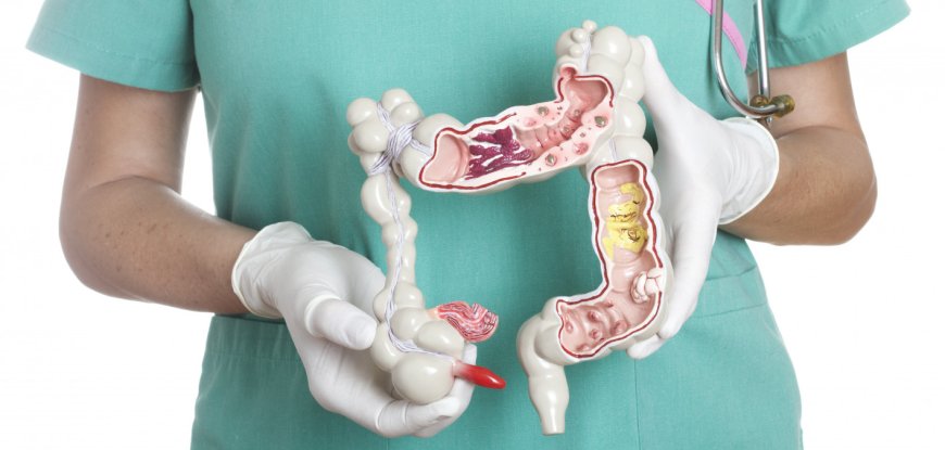 Rising Rates of Gastrointestinal Cancers in Young People Cause Concern