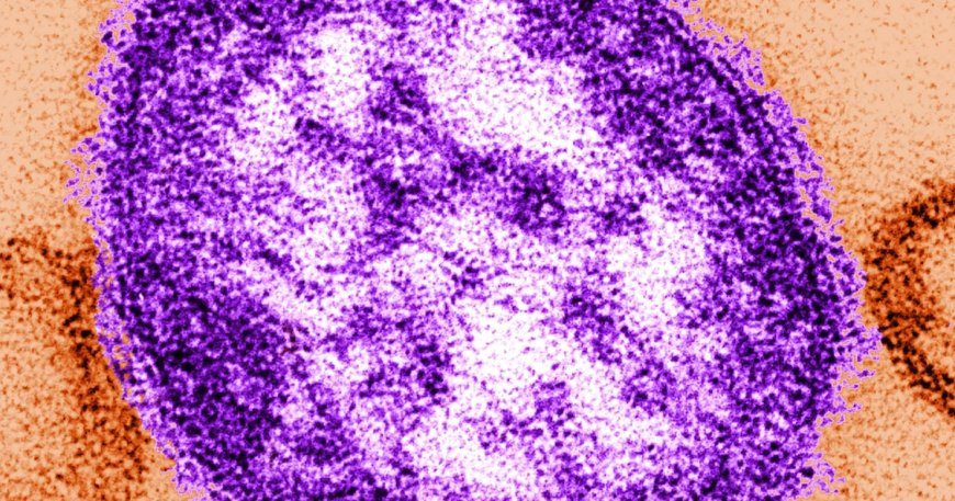 Child in Liverpool dies from measles infection, sparking concern over vaccination rates