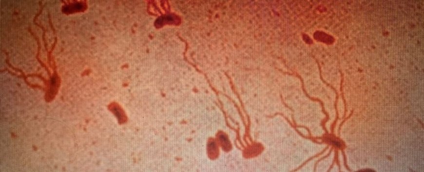 Ancient Typhoid Bacterium Evolving Drug Resistance, Study Warns