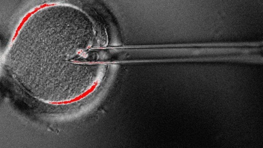 8 Babies Born Using 3-Parent IVF Technique to Prevent Inherited Disease
