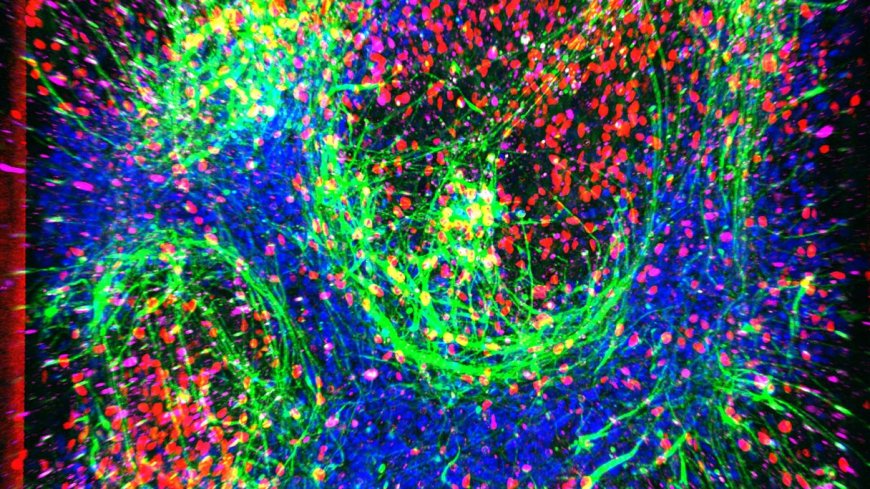 New Pocket-Size Model of ALS Holds Promise for Treatment Development
