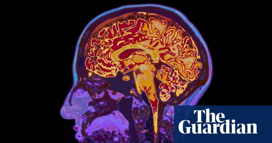 Australia Urgently Needs a Dementia Prevention Campaign, Doctor Urges