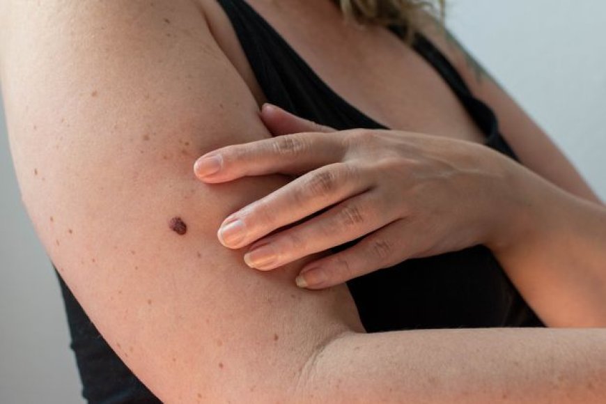 Understanding Itchy Red Bumps: Insect Bites or Skin Condition?
