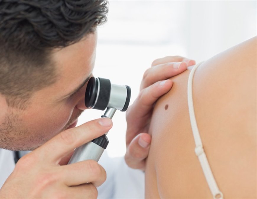Study finds bias in AI models diagnosing skin diseases based on demographics