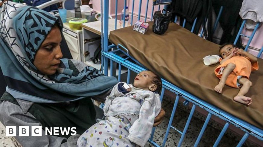 UN Reports One in Five Children in Gaza Suffering from Malnutrition