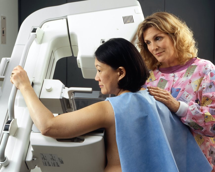 Study Reveals How Surgery Delays Impact Breast Cancer Staging and Tumor Growth Rates